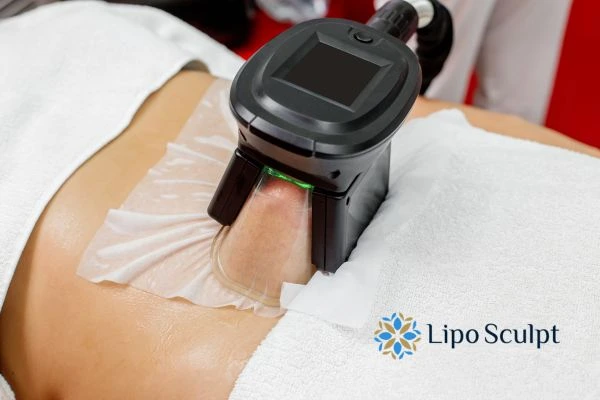 Does Fat Freezing at Home Work? DIY Devices vs Professional Cryolipolysis 1 How is professional cryolipolysis different Elstree?