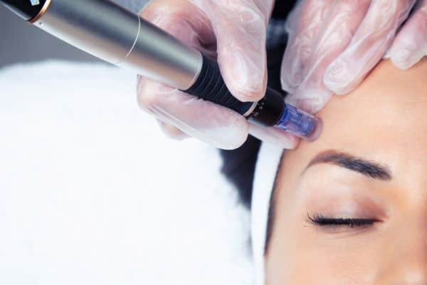 Explaining Total Skin Tightening Treatment and What to Expect 2 What Skin Concerns Can Total Skin Tightening Treatment Help With Elstree?